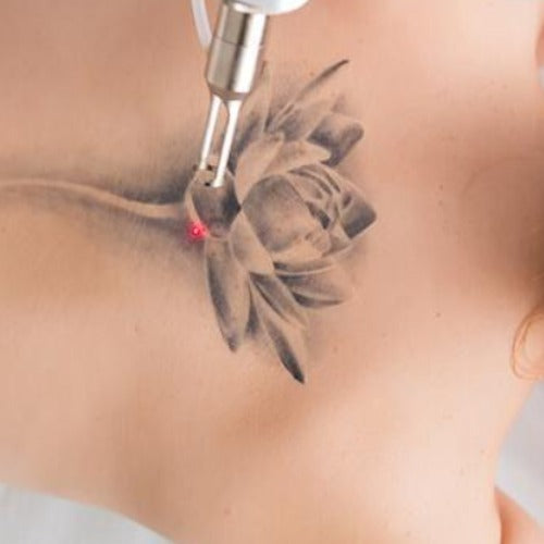 CPD Level 5 Accreditation in Laser Tattoo Removal Treatments