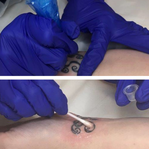 LIFT Non Laser Tattoo Removal Course (Includes FREE bottle of LIFT)